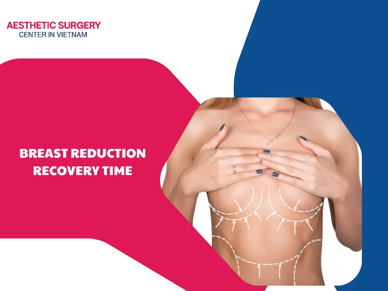 What factors affect breast reduction recovery time? Guide
