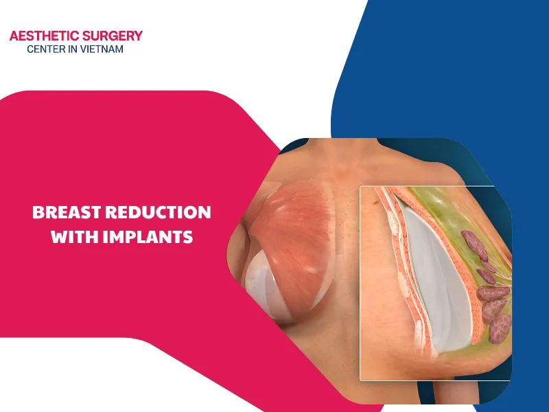 What is breast reduction with implants? What is the process?