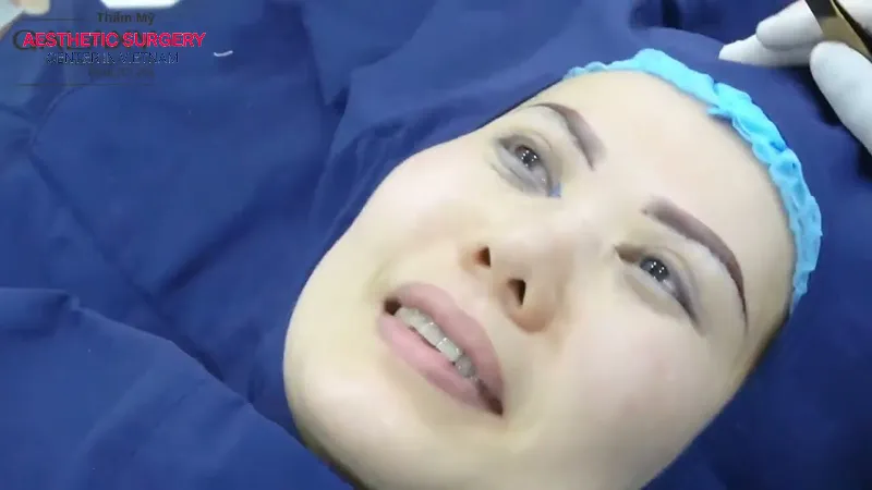 The cost of eyebrow lifting depends on many factors