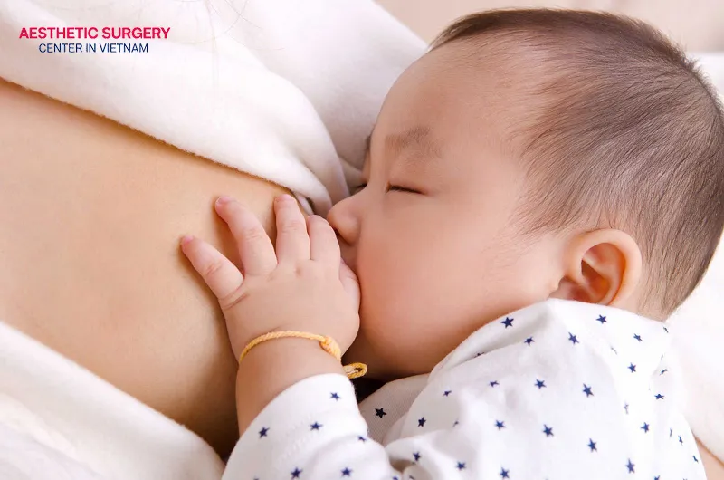Breast reduction surgery can significantly affect milk supply.
