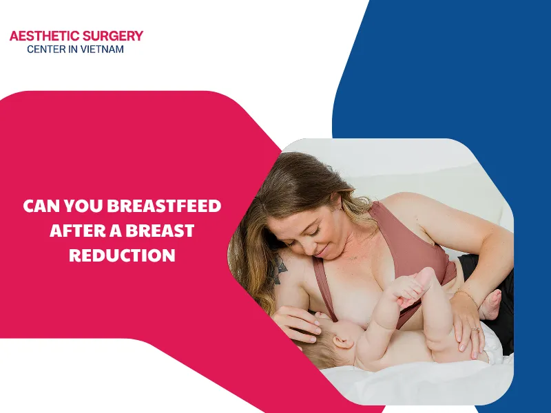 Can you breastfeed after a breast reduction surgery? Is it safe?