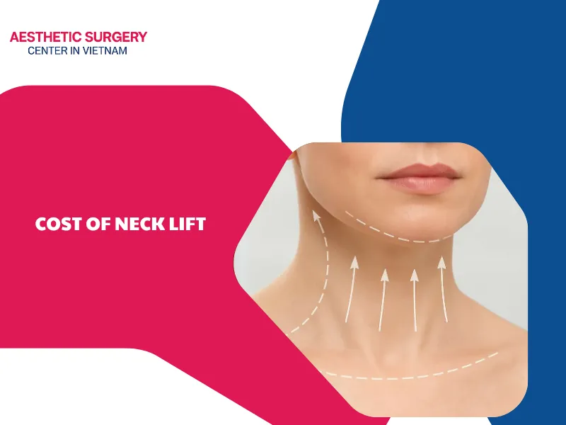 What is the cost of neck lift? Factors affecting the cost