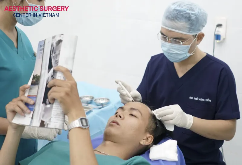 The doctor performs hair transplantation for the client according to standard medical procedures