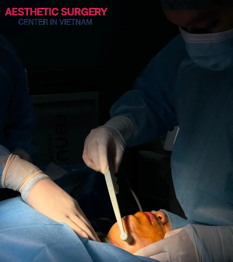 The expertise, skill, and experience of the doctor are vital factors that heavily influence the cost of chin liposuction.
