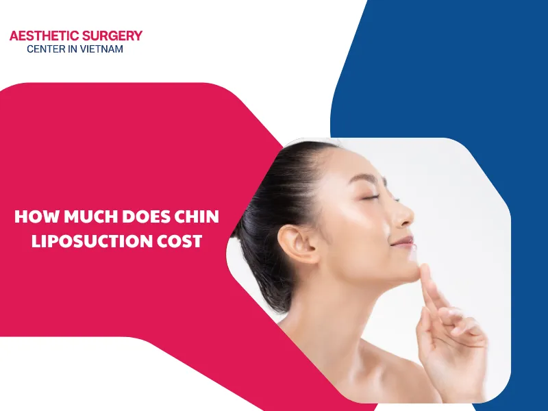 How much does chin liposuction cost? Factors affecting the cost