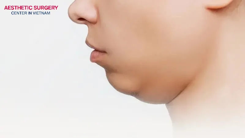Those who have double chin, fat in the upper arms, armpits, etc., that are difficult to lose fat can consider fat-dissolving injections