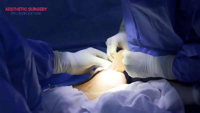 Breast reduction surgery is safe when performed at a reputable medical facility.