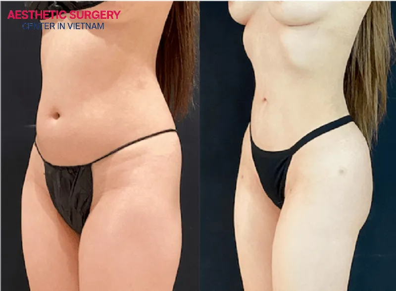 The girl's waist has regained its firmness and slimness