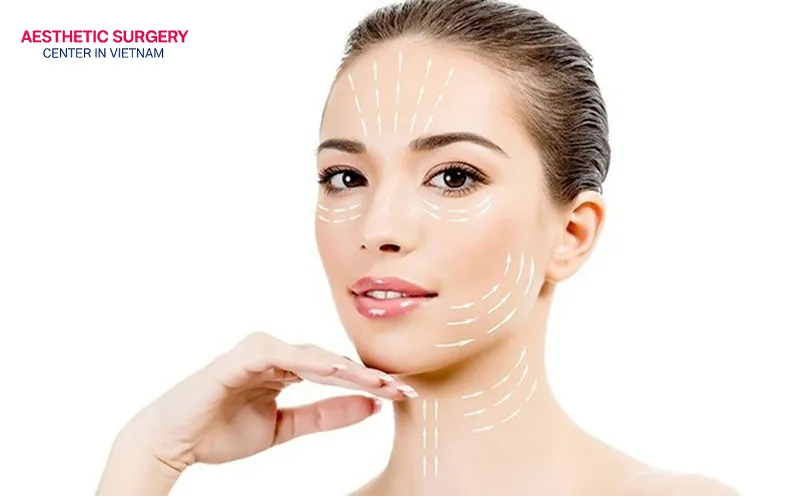 This procedure can reduce deep smile lines and create a more defined jawline.