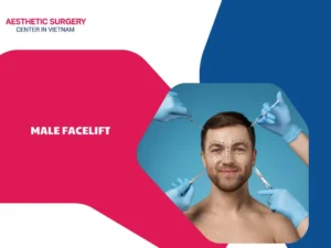 Should you choose a male facelift? Benefits, costs and factors