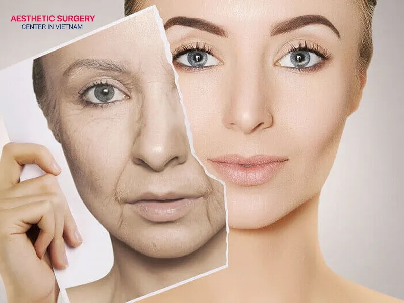 This treatment can significantly improve visible signs of aging.