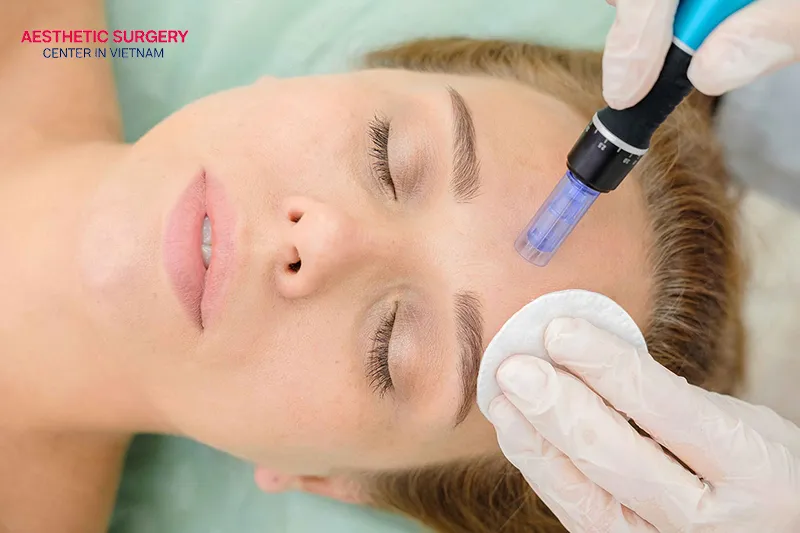 The stem cell facelift procedure is performed to ensure safety and effective results.