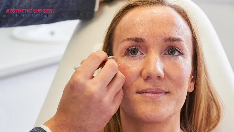 Temple eyebrow lifts offer many outstanding advantages.