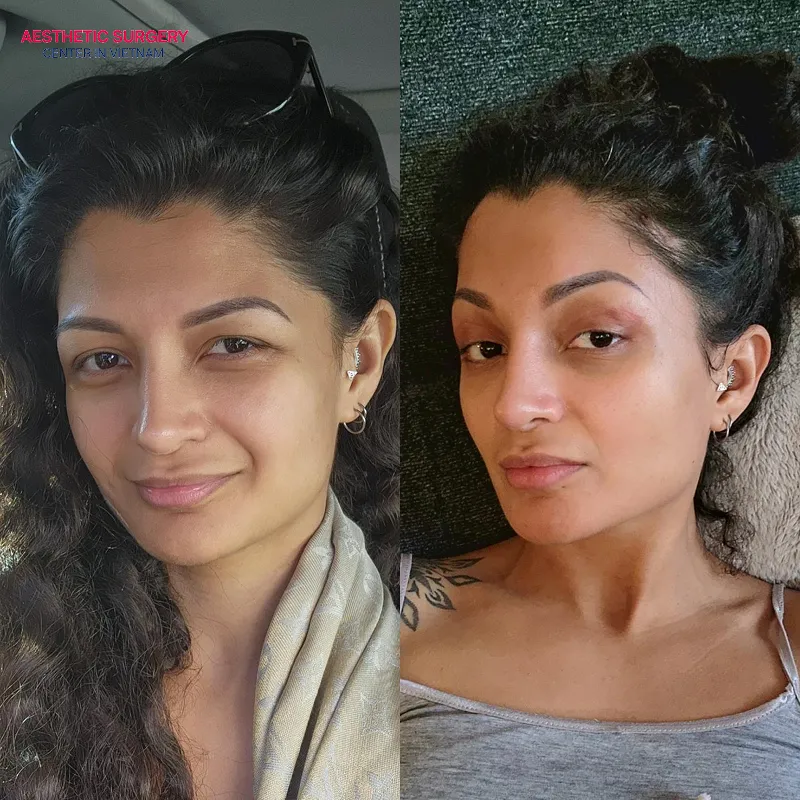You will look younger and more attractive by improving your eyebrows.
