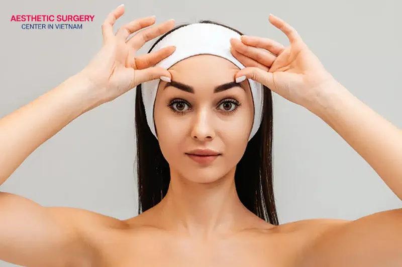 It may take a month or more to achieve the most perfected look after a thread brow lift.