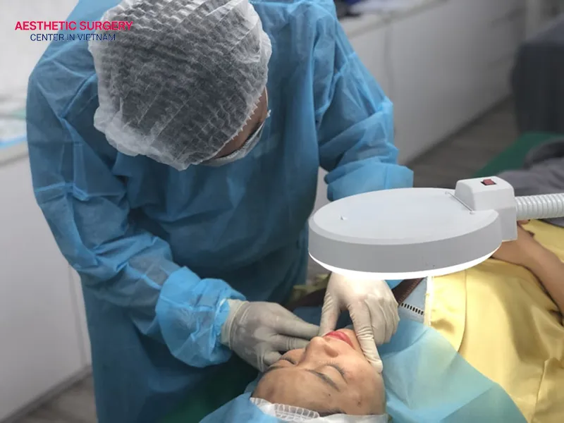 Standard medical procedure for a thread facelift at reputable clinics