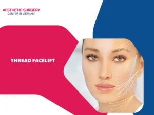 What is a thread facelift? Is this method really effective?