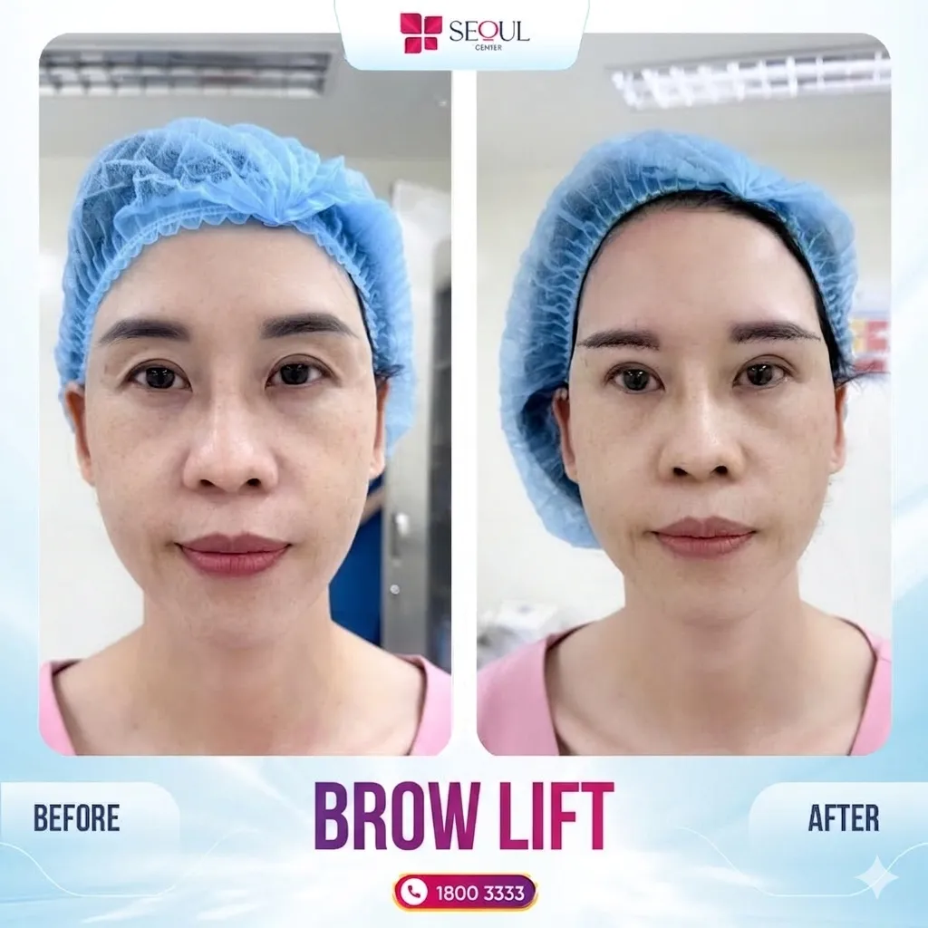 Careful post-surgical care of the treated area will help achieve the desired aesthetic results.