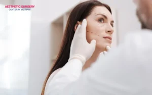 Frequently asked questions about facelift procedures