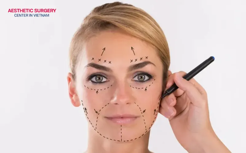 A combined mini facelift with complementary procedures delivers more comprehensive facial rejuvenation results.