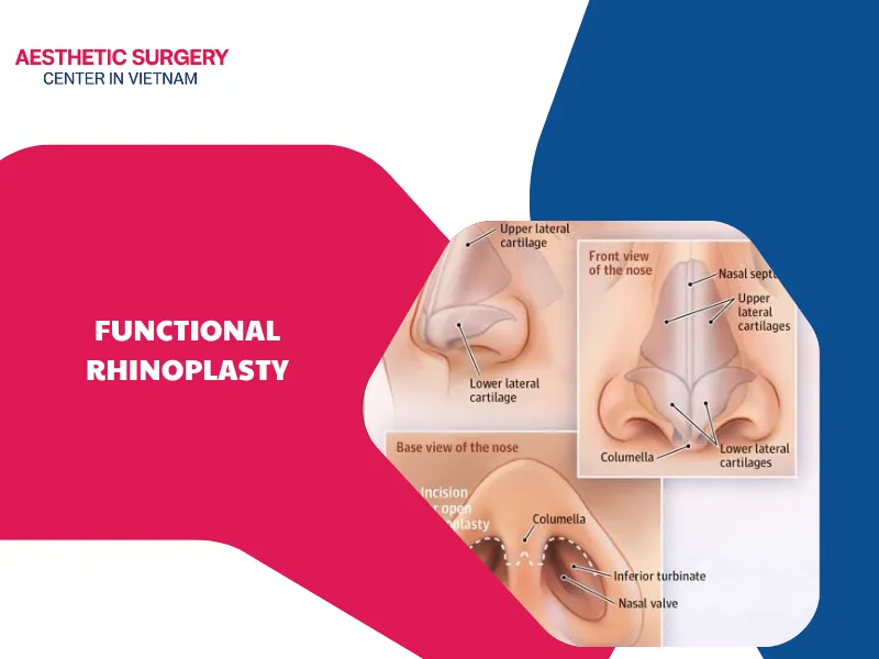 What is functional rhinoplasty? Benefits, procedure, and cost