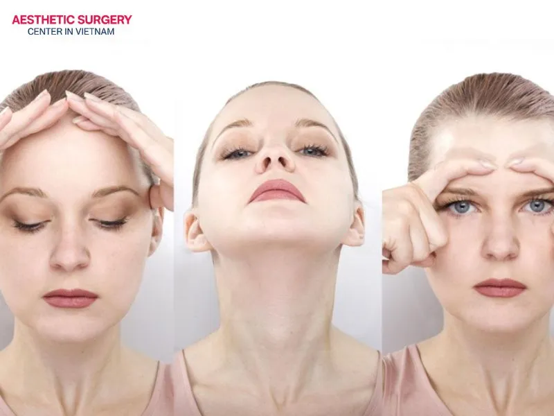 At each stage, the results of neck lift surgery will show changes.
