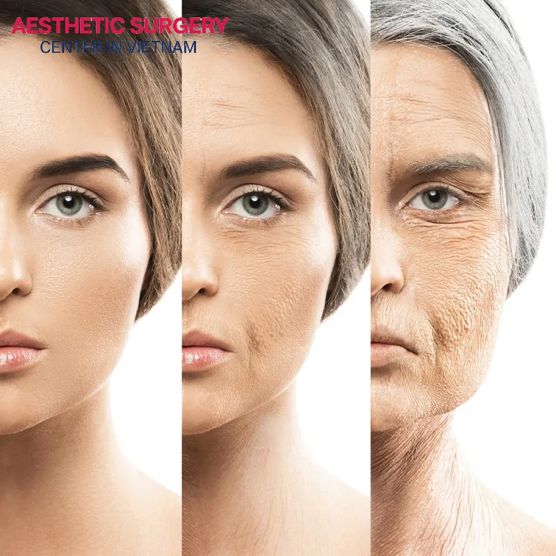 Each stage of midface aging presents different visible signs and characteristics. 