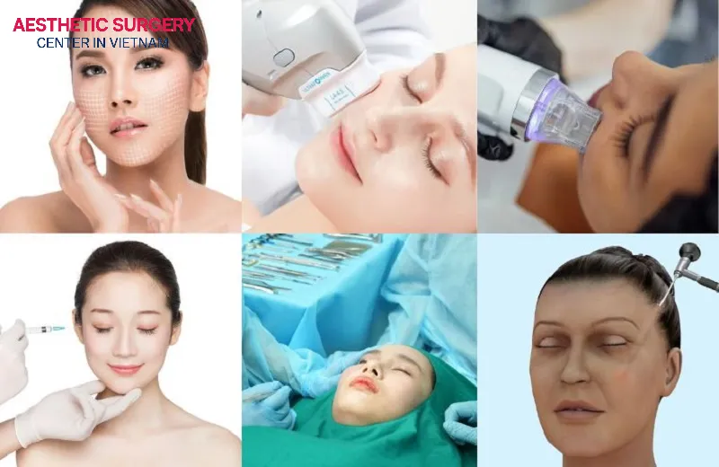 Each facelift method has clear differences in technique, effectiveness, recovery time, and treatment approach.