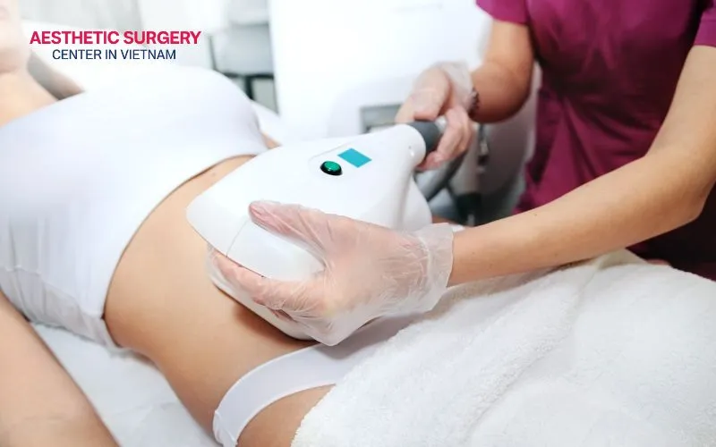 Coolsculpting is a non-invasive treatment that gently targets fat deposits and supports their natural elimination through the lymphatic system.
