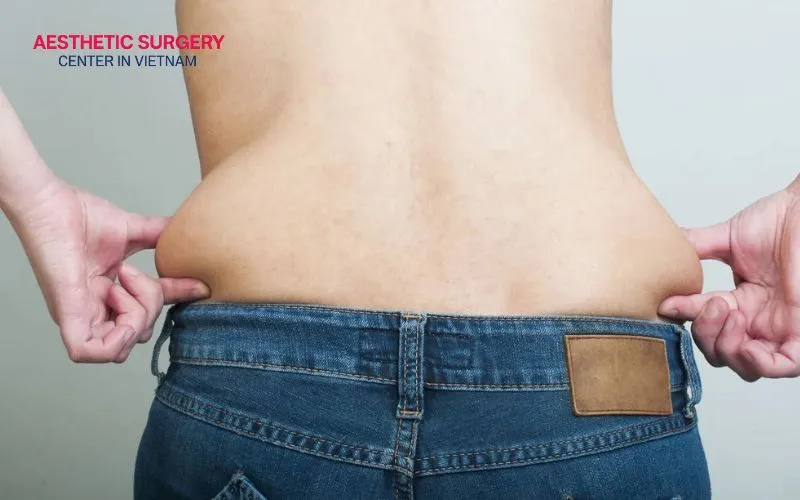 If your goal is simply to achieve a more refined and sculpted body contour, CoolSculpting may be the ideal solution for you.