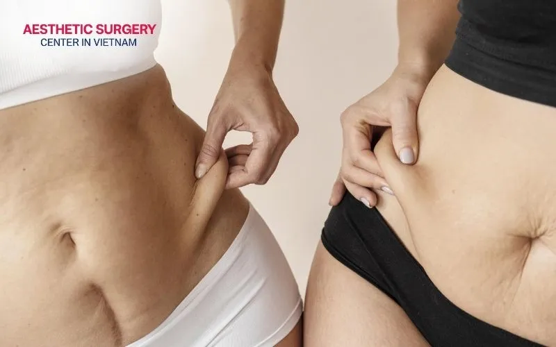 The cost-effectiveness of liposuction vs coolsculpting depends largely on the amount of excess fat being treated and the number of procedures required to achieve the desired results.