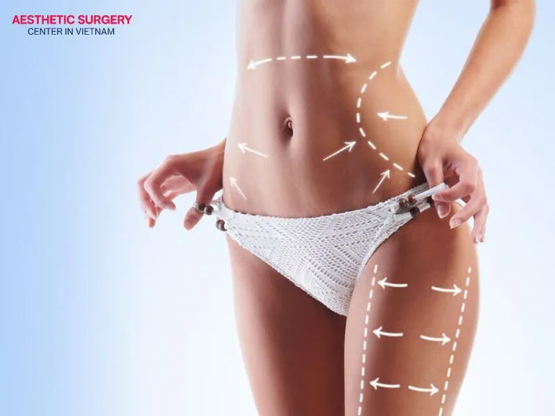The recovery process after micro liposuction is typically much shorter than that of traditional liposuction.