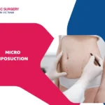 What is micro liposuction? Everything you need to know