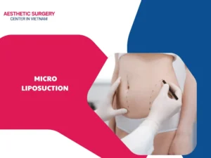 What is micro liposuction? Everything you need to know