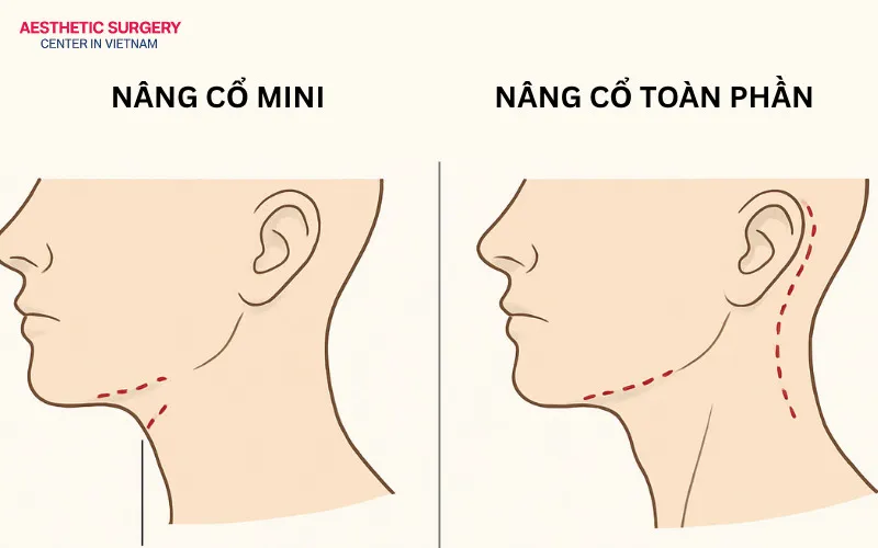 The extent of surgical intervention during the procedure is the most significant difference between the two techniques.