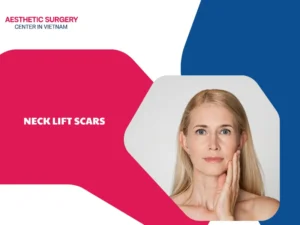 Where are neck lift scars located? Effective prevention methods