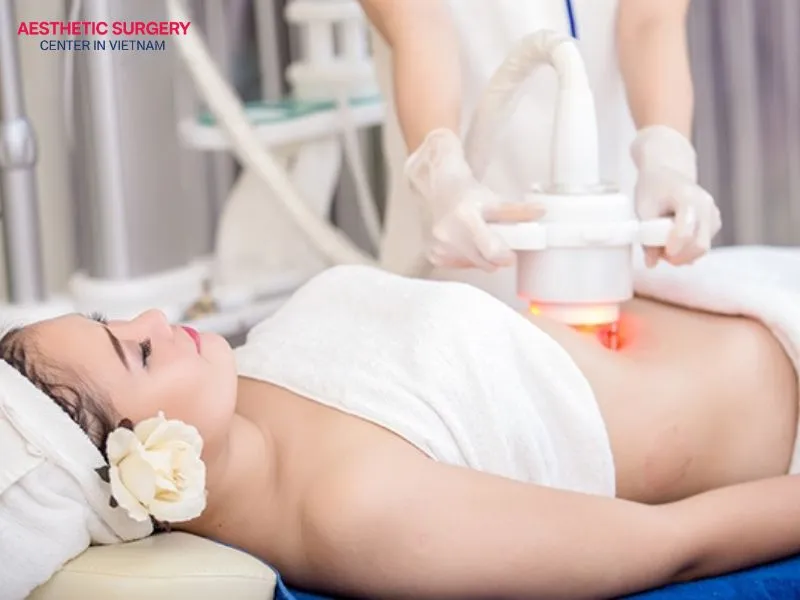 After progressing through three recovery stages, the results of ultrasonic liposuction gradually become more noticeable, helping patients achieve their desired body shape.