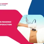 Is ultrasonic liposuction effective? How much does it cost?