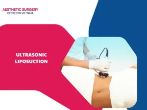 Is ultrasonic liposuction effective? How much does it cost?