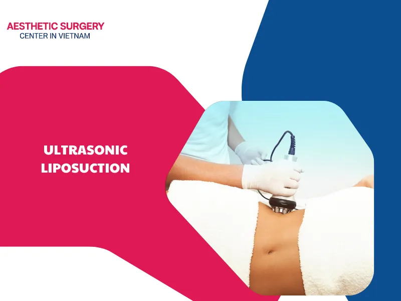 Is ultrasonic liposuction effective? How much does it cost?