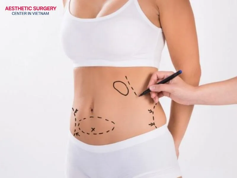 Although laser liposuction offers significant aesthetic benefits, it still carries certain risks and potential side effects