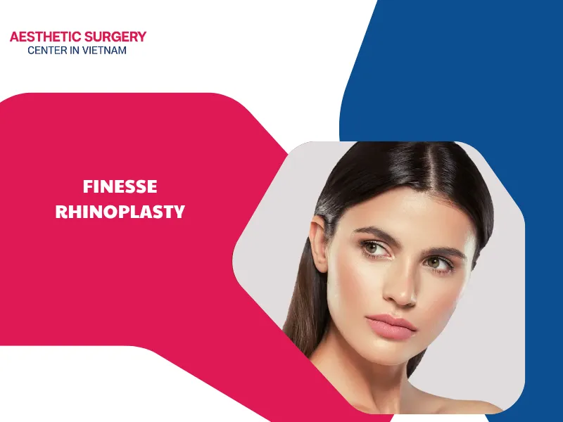 What is a finesse rhinoplasty? Everything you need to know