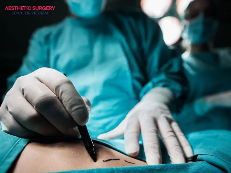 Whether you are suitable for full-body liposuction depends on your health condition, weight, and several other factors.