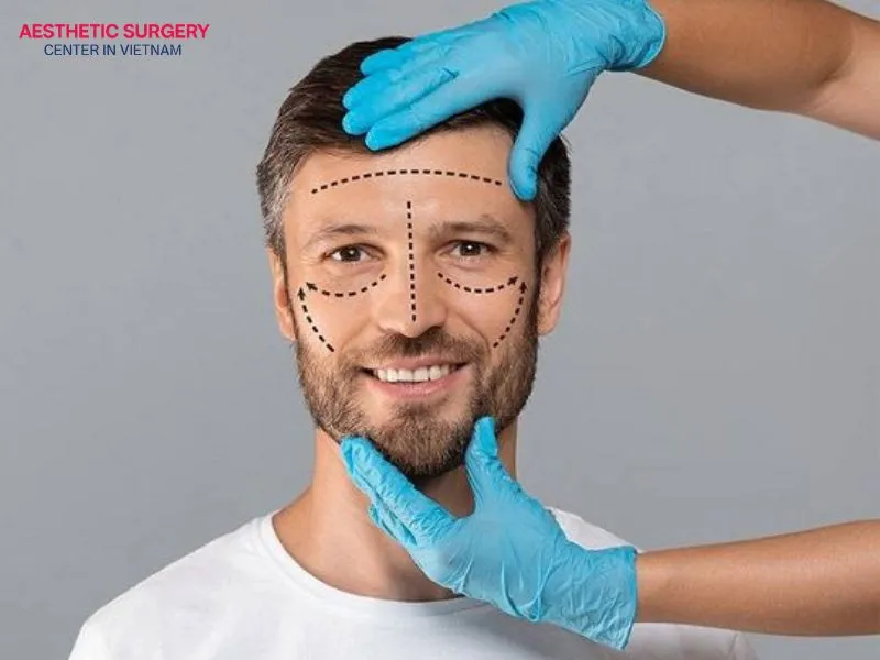 Individuals aged 18 or older who want to improve the appearance of their nose may be a suitable candidate for micro-invasive rhinoplasty.