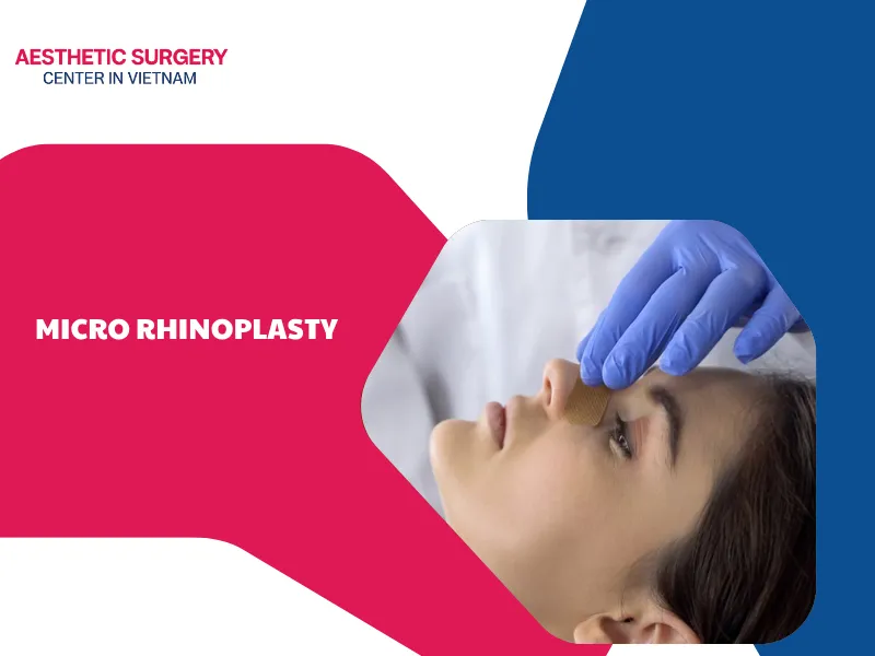 Understanding micro rhinoplasty? What are its key benefits?