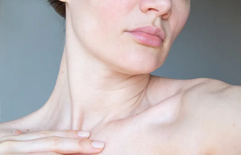 A non surgical neck lift is best suited for individuals with mild neck wrinkles and mild skin laxity.