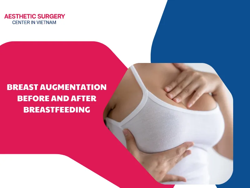 Breast augmentation before and after breastfeeding: Best timing