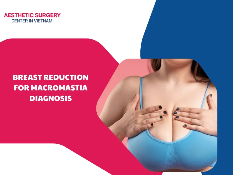 Breast reduction for macromastia diagnosis: Medical benefits