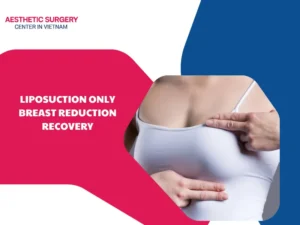 Liposuction only breast reduction recovery: Timeline & Care guide