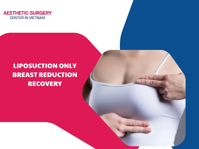 Liposuction only breast reduction recovery: Timeline & Care guide